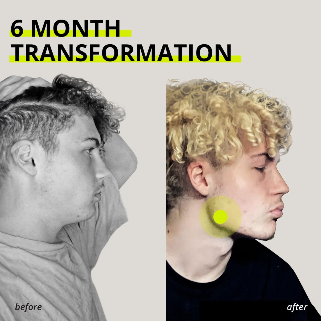 Chicle entrenador de mandíbula Jawliner®