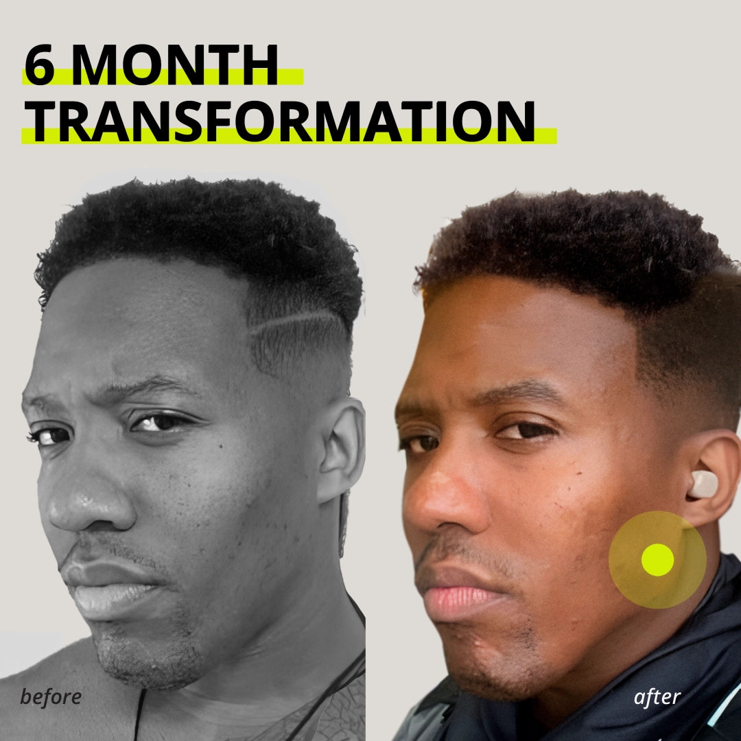 Chicle entrenador de mandíbula Jawliner®