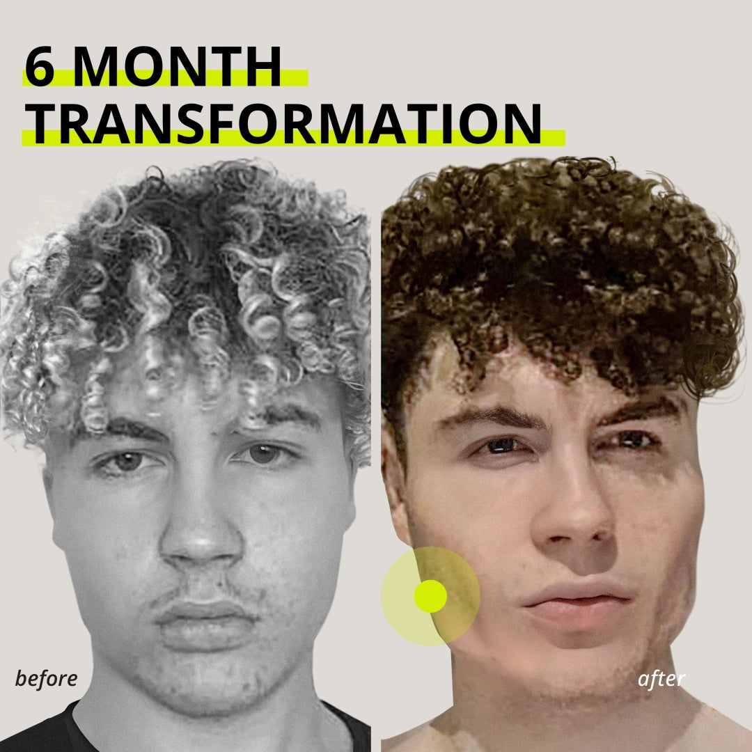 Chicle entrenador de mandíbula Jawliner®